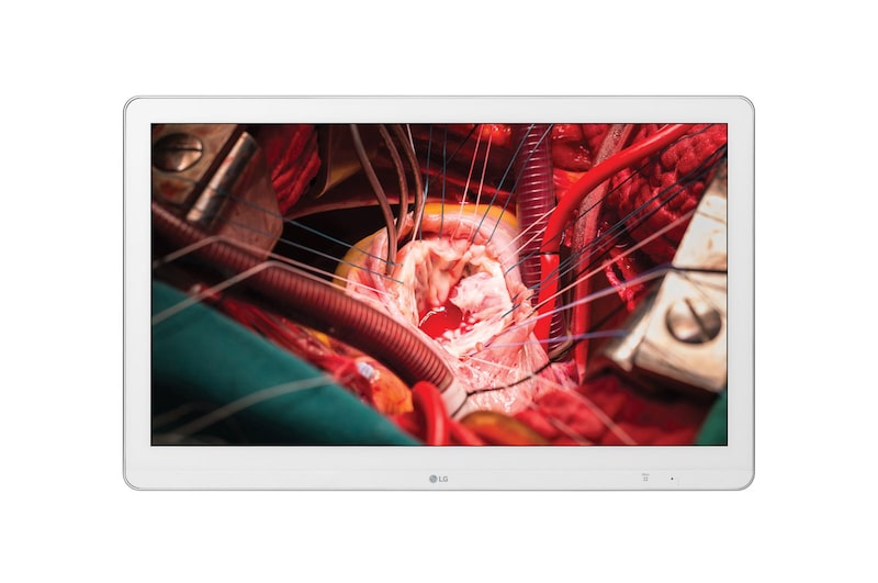 MONITOR MEDICO LG 27' - Imagem 1
